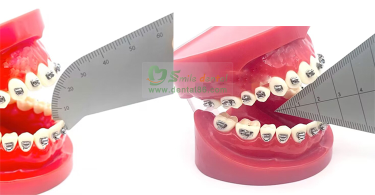 HJC023 Dental Gag Gauge